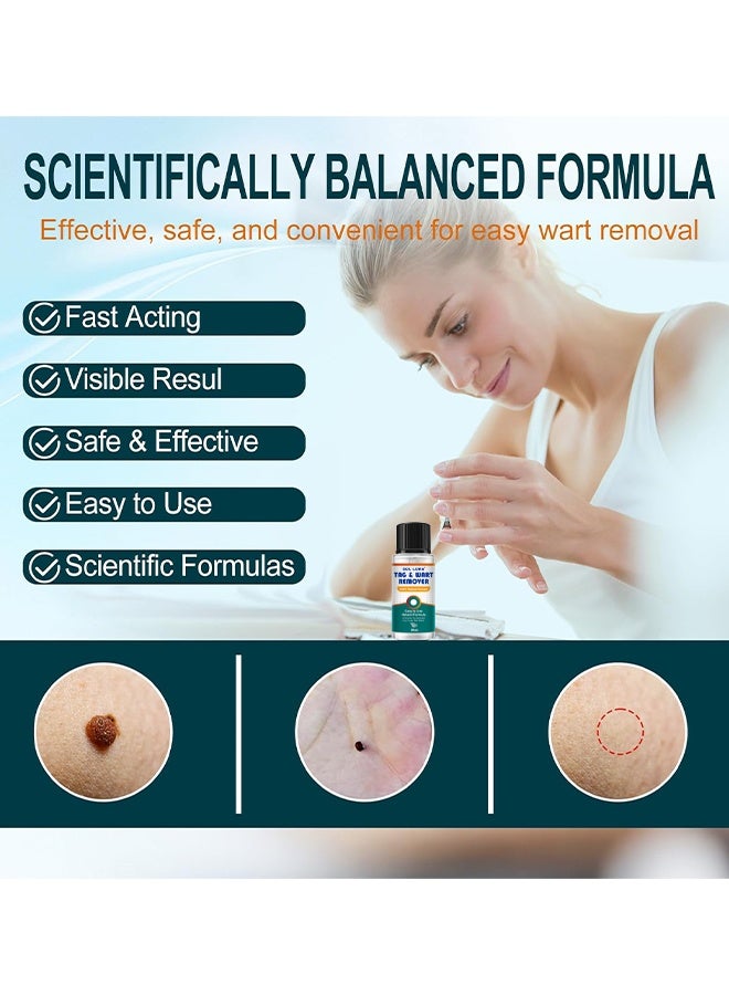 SOL LORA Natural & Safe Wart And Mole Remover Liquid, Wart Remover Liquid, Salicylic Acid Fast-Acting Formula For Plantar Warts, Skin Tags, Corns & Callus Removal, Pain-Free Scar-Free Treatment, Toes & Foot Care For Men & Women, 20ml - Image 3